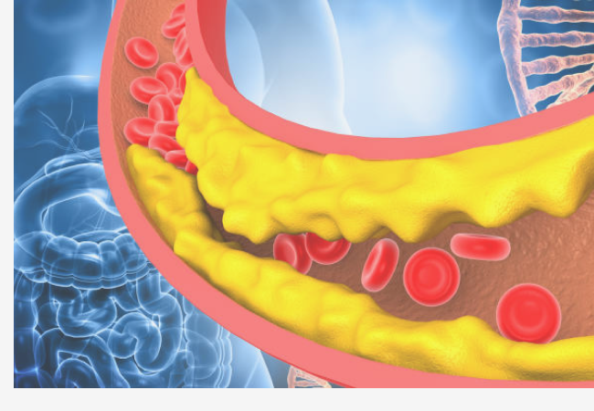 se ve el colesterol en el interior de una vena 